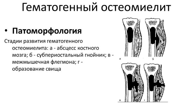 Болят суставы рук и ног. Что делать, к какому врачу обратиться? Причины, симптомы, лечение народными и медикаментозными средствами