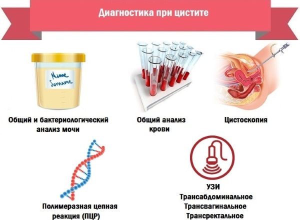 Диета при цистите у женщин, детей, при беременности Список запрещенных и разрешенных продуктов, меню, рецепты