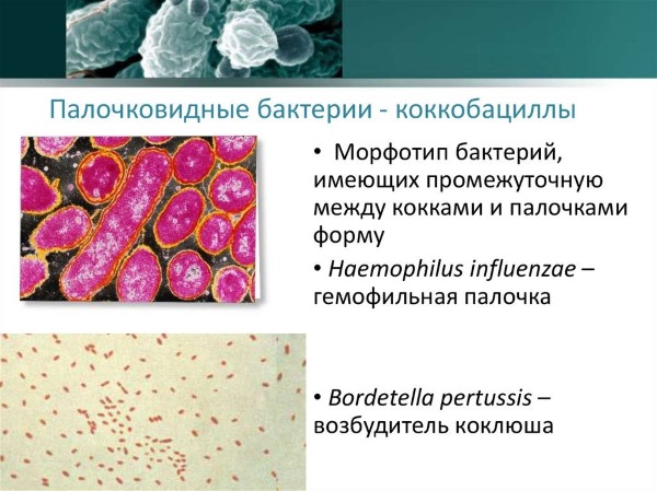 Коккобациллярная флора в мазке: что это такое у мужчин, женщин, при беременности. Норма, как и чем лечить отклонение