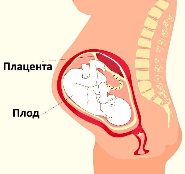 Отслойка плаценты на ранних и поздних сроках беременности. Симптомы, причины и последствия. Чем опасна, как происходит, лечение