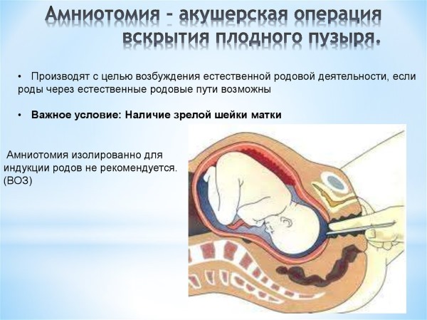 Отслойка плаценты на ранних и поздних сроках беременности. Симптомы, причины и последствия. Чем опасна, как происходит, лечение