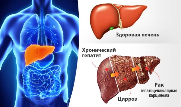 Селезенка: где находится и как болит. Симптомы и причины болей, первая помощь, особенности лечения