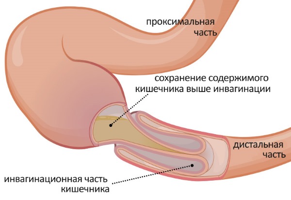 Причины и лечение вздутия живота, газообразования у взрослых. Народные средства. Как быстро избавиться