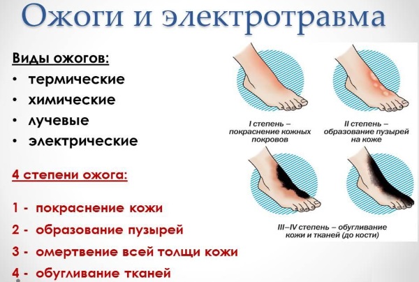 Эплан. Инструкция по применению крема, мази, масла, жидкий раствор, капли. Цена, отзывы врачей, аналоги