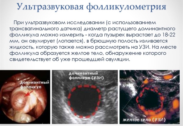 Фолликулометрия: что это такое, как проводится УЗИ малого таза, нормы, подготовка, что показывает, цена