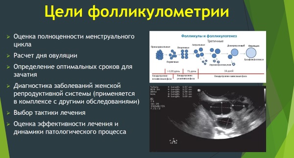 Фолликулометрия: что это такое, как проводится УЗИ малого таза, нормы, подготовка, что показывает, цена