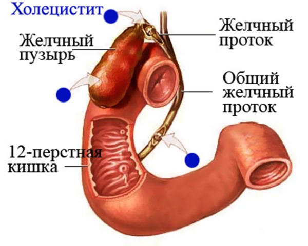 Причины и лечение горечи во рту по утрам, после еды, ночью, после антибиотиков. Как убрать привкус: таблетки, диета