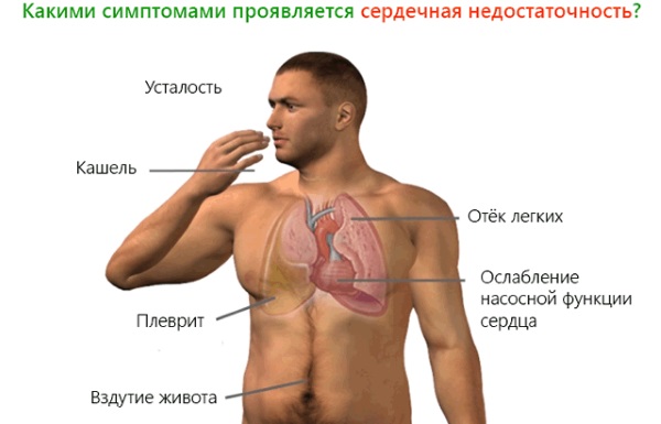 Календула. Полезные свойства для женщин, мужчин и детей. Рецепты применения, противопоказания