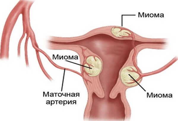 Календула. Полезные свойства для женщин, мужчин и детей. Рецепты применения, противопоказания