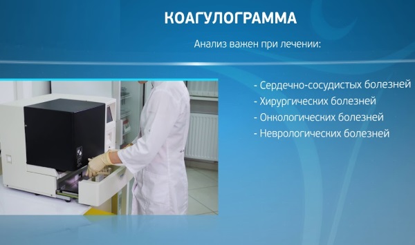 Коагулограмма: что это за анализ, расшифровка, норма в крови у взрослых. Для чего сдают при беременности, перед операцией, как делают гемотест, сколько дней