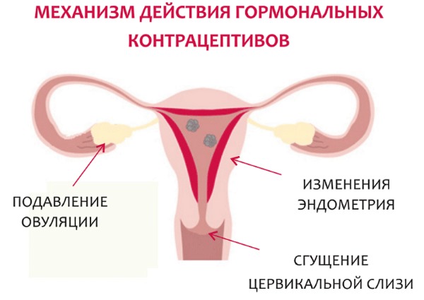 Мажущие выделения в середине цикла без боли. Причины у женщин при приеме противозачаточных