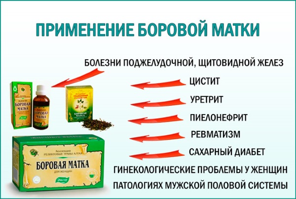 Менопаузальный период. Симптомы и лечение климакса, пред постменопауза. Гормонотерапия и сохранение здоровья женщины. Клинические рекомендации