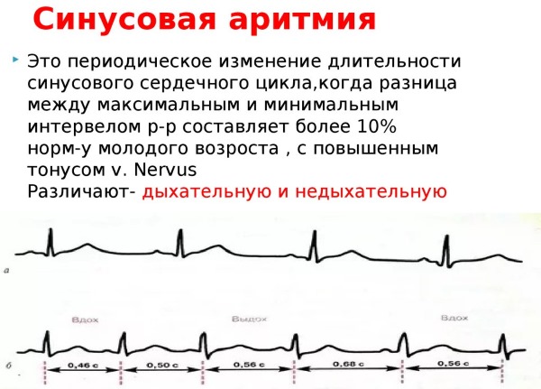 Око Возрождения - 5 тибетских упражнений. Гимнастика, секреты от Питера Кэлдера бесплатно. Видео-уроки