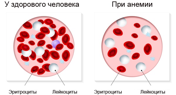 Препараты железа при анемии, для беременных, детей, женщин, мужчин. Польза, как принимать. Список лучших средств, названия и цены