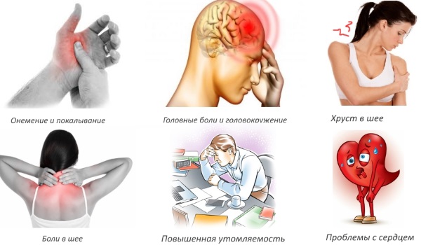 Шейный остеохондроз. Симптомы и лечение в домашних условиях. Упражнения, гимнастика, массаж, уколы, таблетки, мази