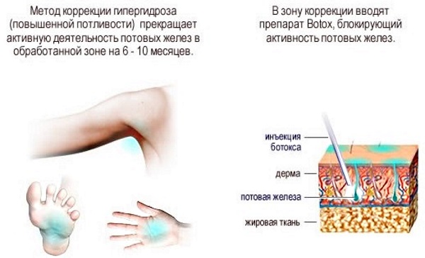 Средства от потливости и запаха ног в аптеке, народные рецепты. Список лучших: Формидрон, 5 дней, Драй Драй