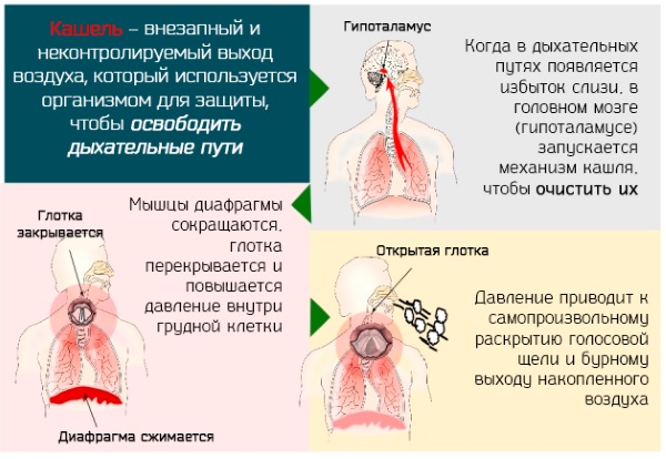 Как лечить сухой кашель у взрослого. Лекарства из аптеки и народные средства