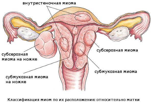 Транексам. Инструкция по применению при маточных кровотечениях, беременности, обильных месячных. Аналоги, цена