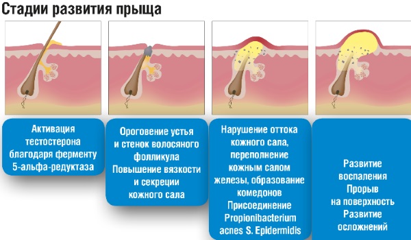 Циновит крем. Инструкция по применению от угрей, прыщей и черных точек, аллергических проявлений. Цена, отзывы, аналоги