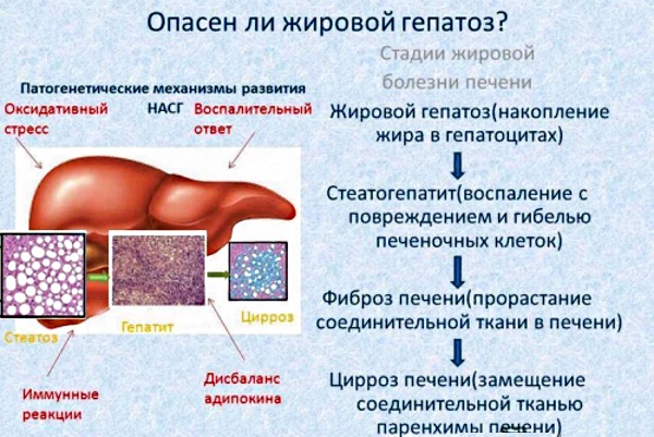 Жировой гепатоз печени. Симптомы и лечение медикаментозное, народными средствами, диета