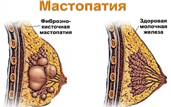 Адамово яблоко. Применение в народной медицине, свойства, способы лечения, настойка для суставов, похудения, потенции