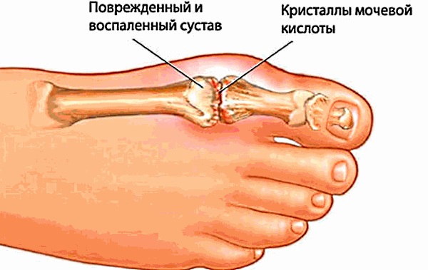 Адамово яблоко. Применение в народной медицине, свойства, способы лечения, настойка для суставов, похудения, потенции