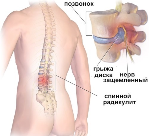 Адамово яблоко. Применение в народной медицине, свойства, способы лечения, настойка для суставов, похудения, потенции