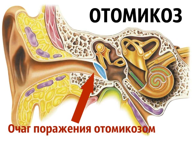 Болит ухо у ребенка левое, правое, стреляет, заложило внутри, сильная боль при глотании, простуде. Причины, чем лечить