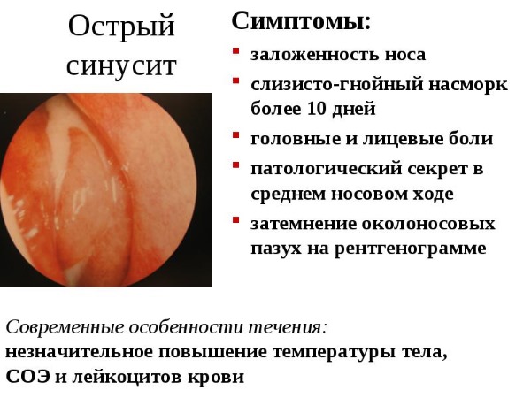 Бронхомунал. Инструкция по применению для детей, цена 10 капсул, аналоги отечественного производителя