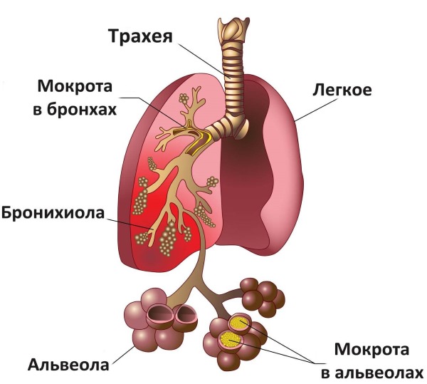 Чем лечить кашель у ребенка без температуры, влажный, сухой, затяжной, лающий, сильный, длительный, с насморком и без