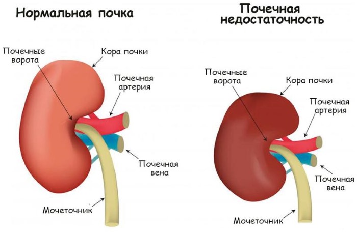 Чесотка у человека фото лечение в домашних условиях thumbnail