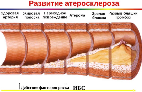 Чистка крови и лимфы в домашних условиях. Народные средства, травы, препараты, продукты питания. Советы врачей