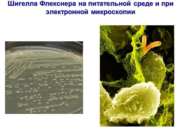 Дизентерия. Симптомы и лечение у взрослых народными средствами, лекарствами. Как передается возбудитель