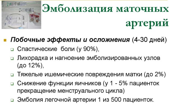 Эмболизация маточных артерий при миоме матки. Что это такое, осложнения, противопоказания. Цена и отзывы пациентов