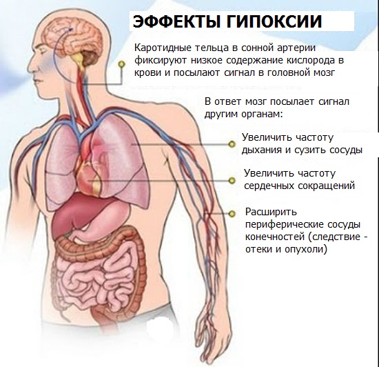 Энцефалопатия головного мозга. Что это такое, симптомы, лечение после инсульта, травмы, наркоза, операции народными средствами, лекарствами