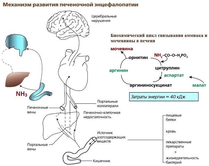 Энцефалопатия головного мозга. Что это такое, симптомы, лечение после инсульта, травмы, наркоза, операции народными средствами, лекарствами