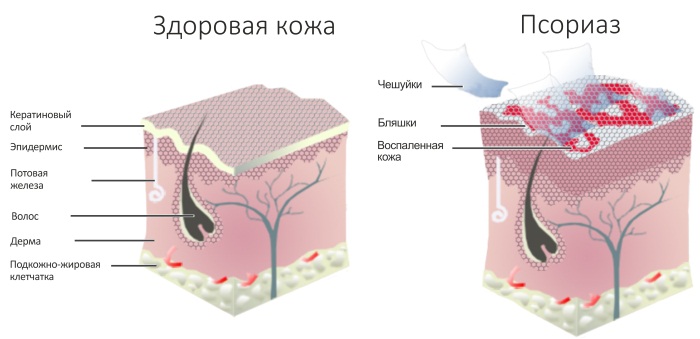 Флуцинар мазь. Инструкция по применению, состав, показания, от чего помогает, для чего применяется в гинекологии. Цена, отзывы, аналоги