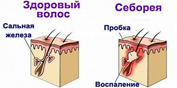 Гидрокартизованная мазь. Инструкция по применению, показания для детей, взрослых, в гинекологии, косметологии, медицине. Цена, аналоги