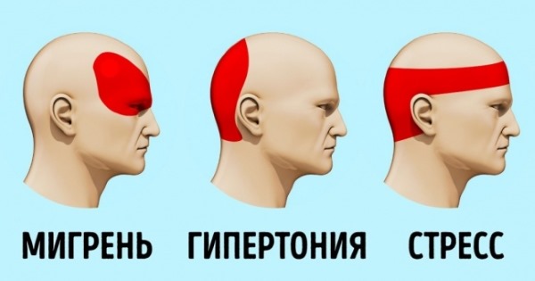 Головные боли у женщин. Причины, лечение цервикокраниалгии, сосудистых напряжений, кластерных, в виске, затылке, лобной части