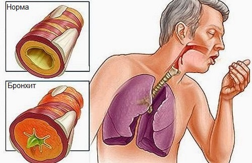 Грудной эликсир. Инструкция по применению для детей, состав, как принимать от кашля, от чего помогает