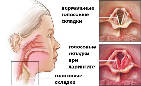 Грудной эликсир. Инструкция по применению для детей, состав, как принимать от кашля, от чего помогает