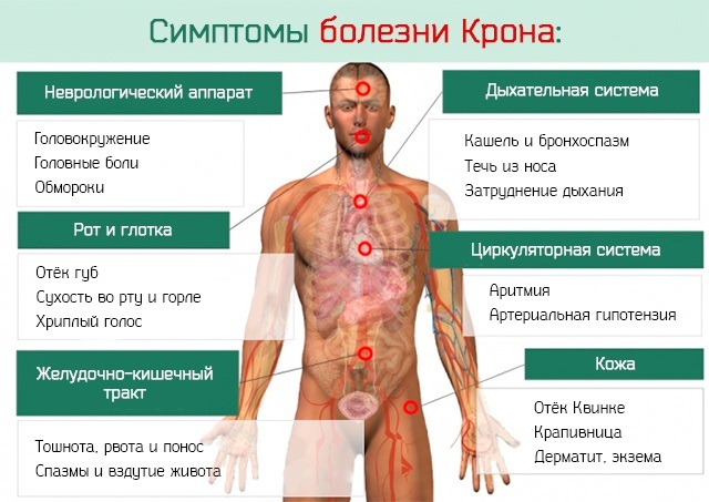 Ирригоскопия кишечника. Подготовка, как проводится, что показывает, чем лучше колоноскопии, МРТ. Где сделать