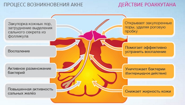 Изотретиноин. Инструкция по применению таблеток, мази, геля от прыщей. Побочные действия, цены