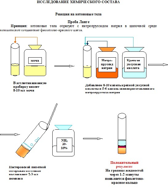 Кетоновые тела в моче. Что значит повышены, слабо-положительно. Норма ммоль/л, анализ, тест-полоски