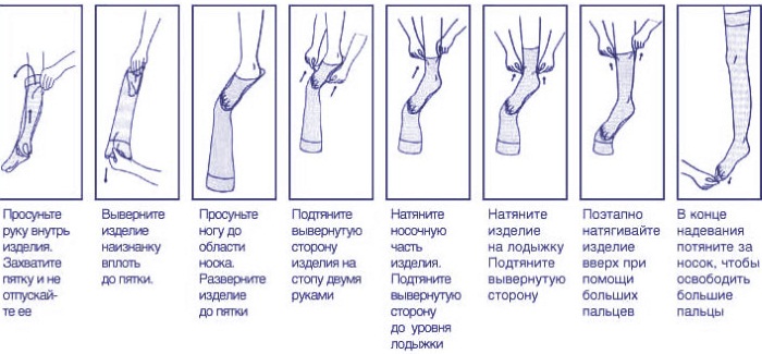 Компрессионные чулки 1, 2 класс для операции, беременных, после родов, для мужчин. Как выбрать размер, надевать, носить, стирать