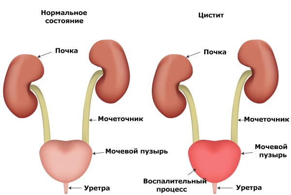 Лиз Бурбо. Таблица болезней в алфавитном порядке. Метафизика, психосоматика травм, заболеваний, температуры, тошноты, боли