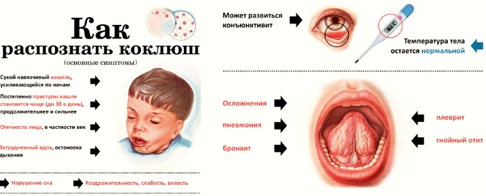 Лучшие средства от сухого кашля, недорогое, эффективное: сиропы, таблетки, народные средства