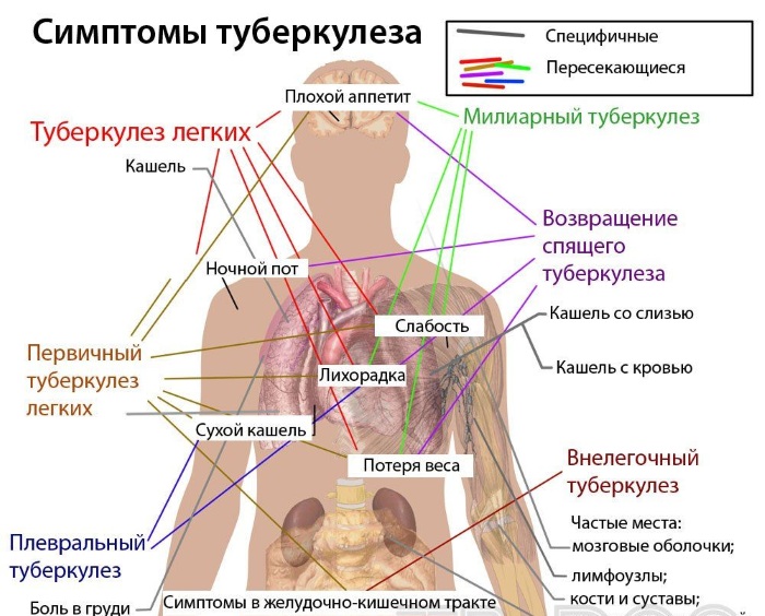 Лучшие средства от сухого кашля, недорогое, эффективное: сиропы, таблетки, народные средства