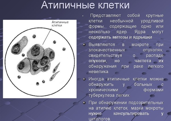 Мазок на онкоцитологию. Что это, норма, расшифровка, когда сдавать, как подготовиться, сколько делается