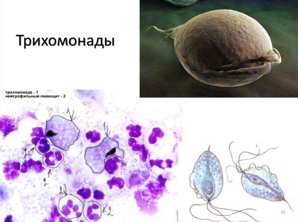 Мазок на онкоцитологию. Что это, норма, расшифровка, когда сдавать, как подготовиться, сколько делается